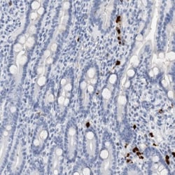 S100A8 Antibody, Novus Biologicals:Antibodies:Primary Antibodies