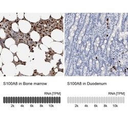 S100A8 Antibody, Novus Biologicals:Antibodies:Primary Antibodies