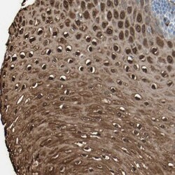 S100A9 Antibody, Novus Biologicals:Antibodies:Primary Antibodies
