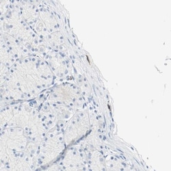 S100A9 Antibody, Novus Biologicals:Antibodies:Primary Antibodies