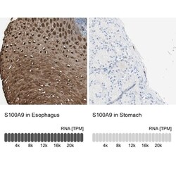 S100A9 Antibody, Novus Biologicals:Antibodies:Primary Antibodies