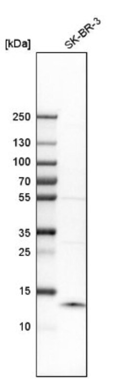 S100A9 Antibody, Novus Biologicals:Antibodies:Primary Antibodies