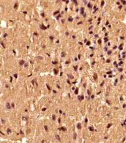 S100B Antibody (15F4NB) - Azide and BSA Free, Novus Biologicals:Antibodies:Primary