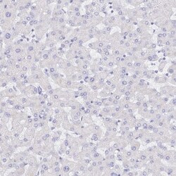 S100G Antibody, Novus Biologicals 0.1mL; Unlabeled:Antibodies, Polyclonal