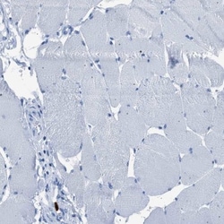 S100P Antibody, Novus Biologicals:Antibodies:Primary Antibodies