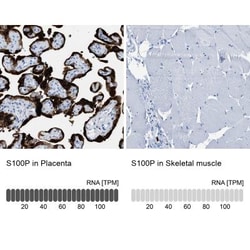 S100P Antibody, Novus Biologicals:Antibodies:Primary Antibodies
