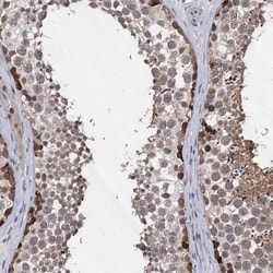 S5a/Angiocidin Antibody, Novus Biologicals:Antibodies:Primary Antibodies