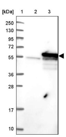 S5a/Angiocidin Antibody, Novus Biologicals:Antibodies:Primary Antibodies