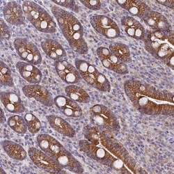 SACM1L Antibody, Novus Biologicals:Antibodies:Primary Antibodies
