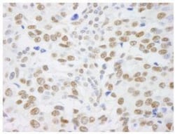SAFB Antibody, Novus Biologicals 0.1 mL | Buy Online | Novus Biologicals | Fisher Scientific