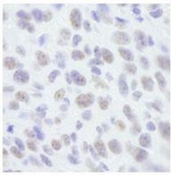 SAFB Antibody, Novus Biologicals 0.1 mL | Buy Online | Novus Biologicals | Fisher Scientific
