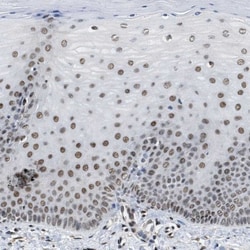 SAFB Antibody, Novus Biologicals:Antibodies:Primary Antibodies