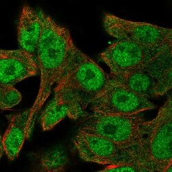 SALL1 Antibody, Novus Biologicals 0.1mL; Unlabeled:Antibodies, Polyclonal