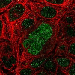 SALL4 Antibody, Novus Biologicals 0.1mL; Unlabeled:Antibodies, Polyclonal