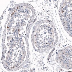 SALL4 Antibody, Novus Biologicals 0.1mL; Unlabeled:Antibodies, Polyclonal