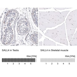 SALL4 Antibody, Novus Biologicals 0.1mL; Unlabeled:Antibodies, Polyclonal