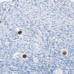 SALL4 Antibody, Novus Biologicals:Antibodies:Primary Antibodies