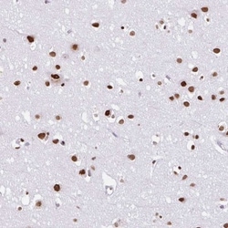 SAM68 Antibody, Novus Biologicals 0.1mL; Unlabeled:Antibodies, Polyclonal