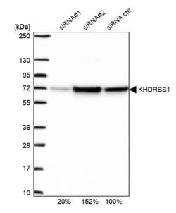 SAM68 Antibody, Novus Biologicals 0.1mL; Unlabeled:Antibodies, Polyclonal