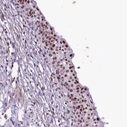 SAMD10 Antibody, Novus Biologicals 0.1mL; Unlabeled:Antibodies, Polyclonal