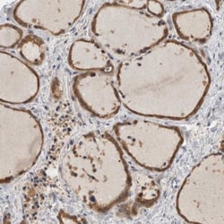 SAMD12 Antibody, Novus Biologicals 0.1mL; Unlabeled:Antibodies, Polyclonal