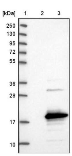 SAMD12 Antibody, Novus Biologicals 0.1mL; Unlabeled:Antibodies, Polyclonal