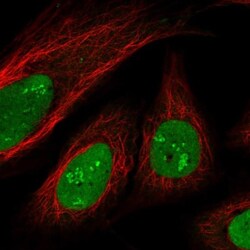 SAMD14 Antibody, Novus Biologicals:Antibodies:Primary Antibodies