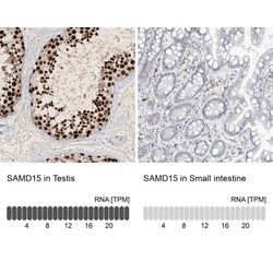SAMD15 Antibody, Novus Biologicals 25 &mu;L | Buy Online | Novus Biologicals | Fisher Scientific