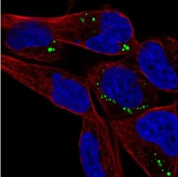 SAMD5 Antibody, Novus Biologicals:Antibodies:Primary Antibodies