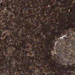 SAMD9 Antibody, Novus Biologicals 0.1 mL | Buy Online | Novus Biologicals | Fisher Scientific