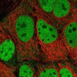 SAMHD1 Antibody, Novus Biologicals 25 &mu;L; Unlabeled:Antibodies, Polyclonal