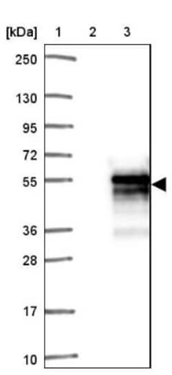 SAP30BP Antibody, Novus Biologicals 0.1mL; Unlabeled:Antibodies, Polyclonal