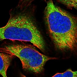 SAPS2 Antibody, Novus Biologicals 25 &mu;L; Unlabeled:Antibodies, Polyclonal