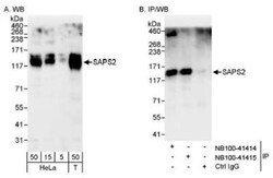 SAPS2 Antibody, Novus Biologicals 0.1 mL | Buy Online | Novus Biologicals | Fisher Scientific