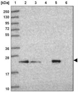 SAR1B Antibody, Novus Biologicals 0.1mL; Unlabeled:Antibodies, Polyclonal
