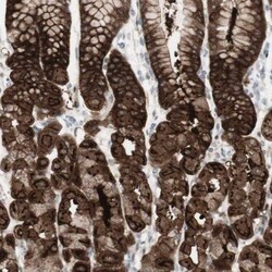 SARG Antibody, Novus Biologicals 0.1mL; Unlabeled:Antibodies, Polyclonal