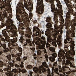 SARG Antibody, Novus Biologicals 0.1mL; Unlabeled:Antibodies, Polyclonal