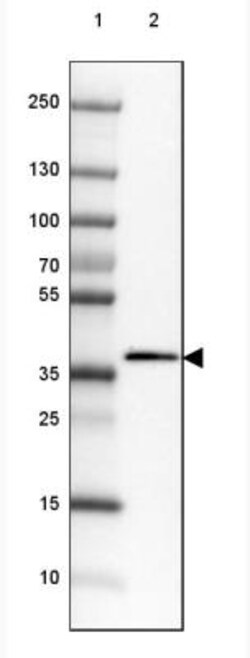 SARG Antibody, Novus Biologicals 0.1mL; Unlabeled:Antibodies, Polyclonal