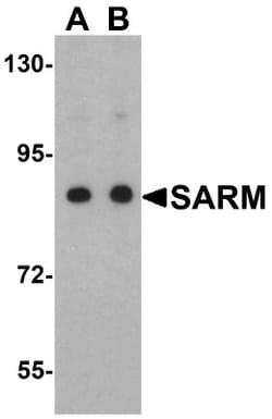 SARM1 Antibody - BSA Free, Novus Biologicals 0.1mg; Unlabeled:Antibodies,