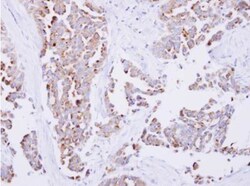 SARS2 Antibody, Novus Biologicals 0.1mL; Unlabeled:Antibodies, Polyclonal