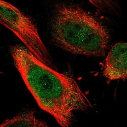 SART2 Antibody, Novus Biologicals 0.1mL; Unlabeled:Antibodies, Polyclonal