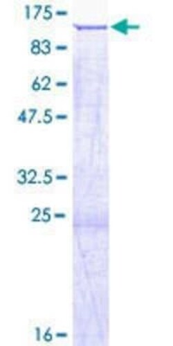 Novus Biologicals Recombinant Human SATB2 GST (N-Term) Protein 2 &mu;g | Buy Online | Novus Biologicals&trade; | Fisher Scientific