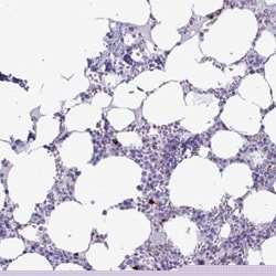 SATL1 Antibody, Novus Biologicals:Antibodies:Primary Antibodies