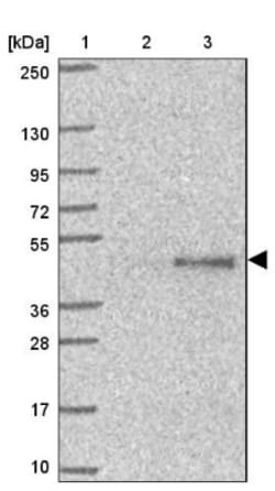 SAV1 Antibody, Novus Biologicals 25 &mu;L, Unlabeled:Antibodies, Polyclonal