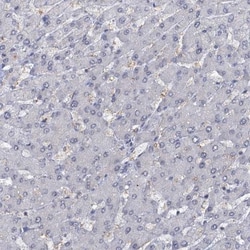 SBEM Antibody, Novus Biologicals 0.1mL; Unlabeled:Antibodies, Polyclonal