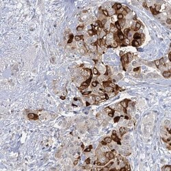 SBEM Antibody, Novus Biologicals 0.1mL; Unlabeled:Antibodies, Polyclonal