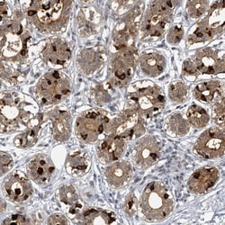 SBEM Antibody, Novus Biologicals 0.1mL; Unlabeled:Antibodies, Polyclonal