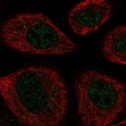 SBK2 Antibody, Novus Biologicals:Antibodies:Primary Antibodies