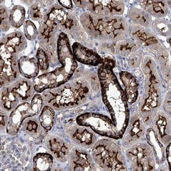 SBK2 Antibody, Novus Biologicals:Antibodies:Primary Antibodies