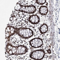 SCAF8/RBM16 Antibody, Novus Biologicals 25 &mu;L; Unlabeled:Antibodies,